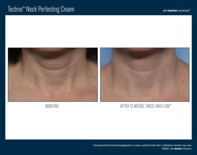 TECHNO NECK PERFECTING CREAM | Face and neck cream | LOSHEN & CREM