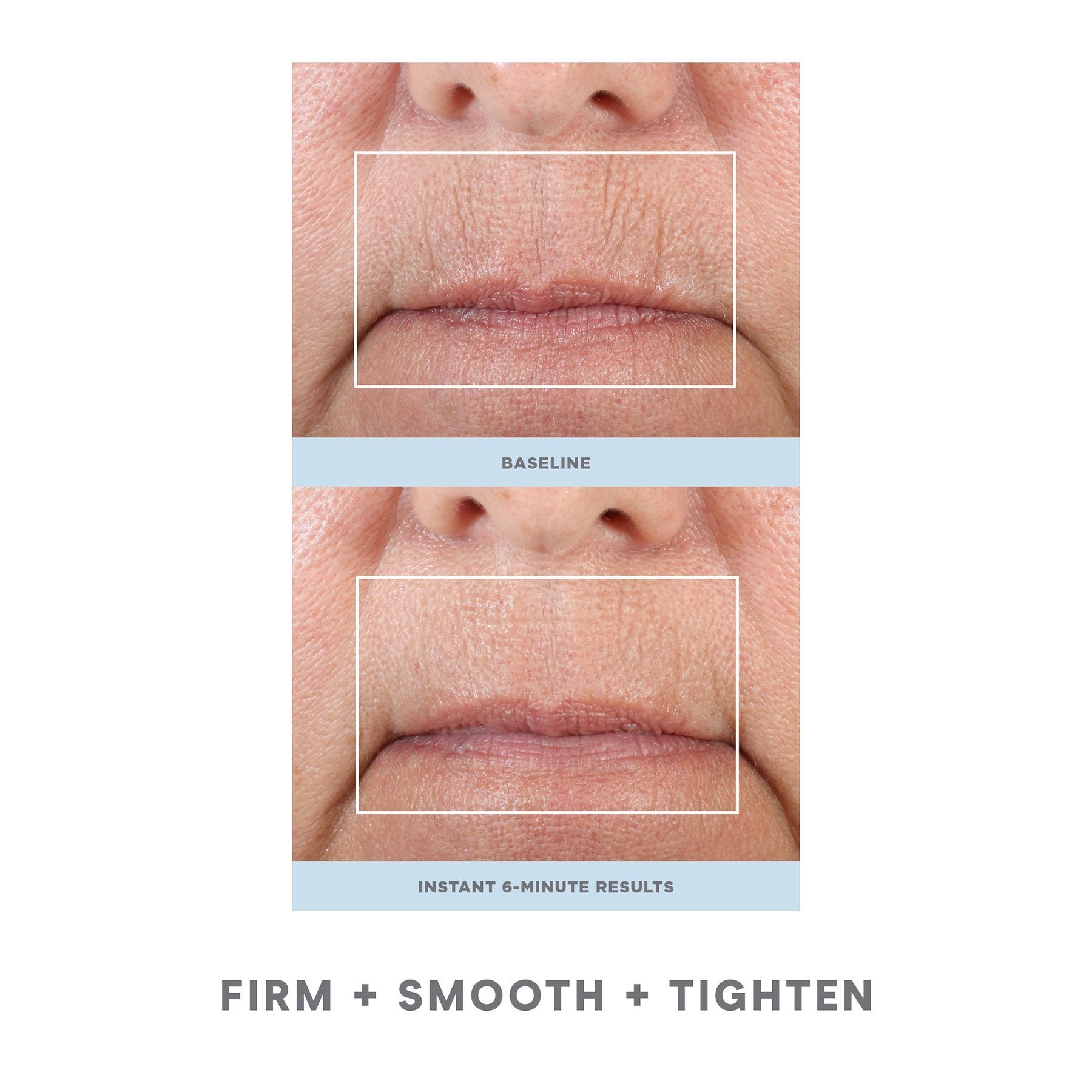 NuFACE® Fix micro wand | Microcurrent | LOSHEN & CREM