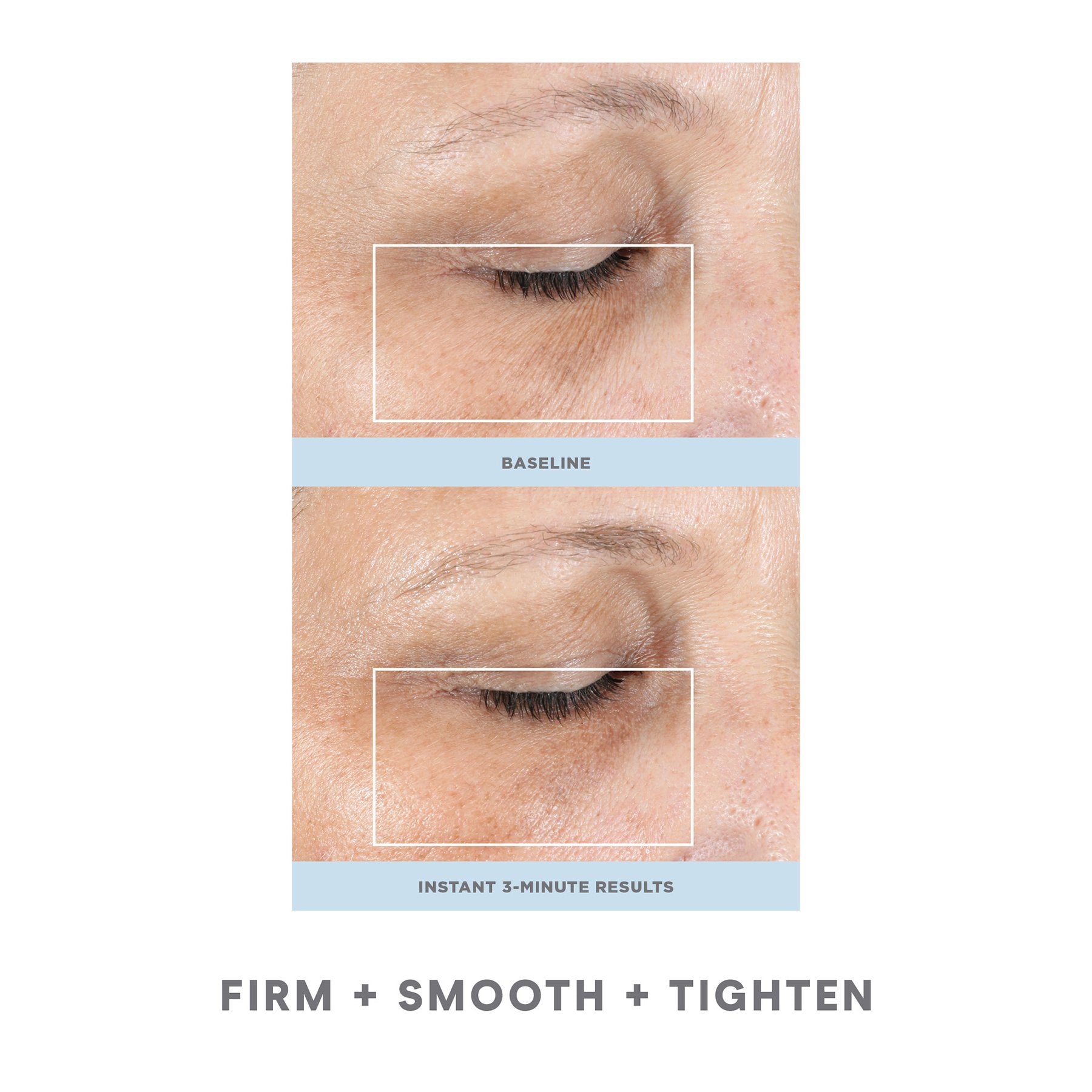 NuFACE® Fix micro wand | Microcurrent | LOSHEN & CREM