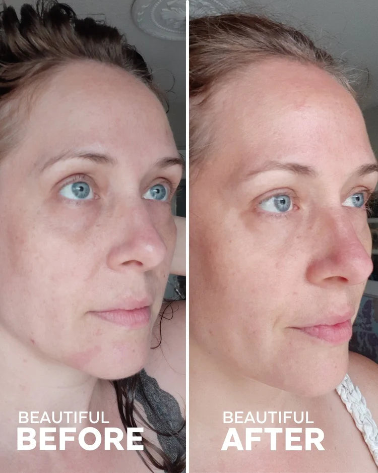 Refresh Papaya + Salicylic Acid Cleanse | Cleansing - Foam | LOSHEN & CREM