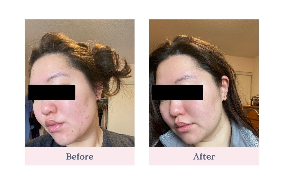 Refresh Papaya + Salicylic Acid Cleanse | Cleansing - Foam | LOSHEN & CREM