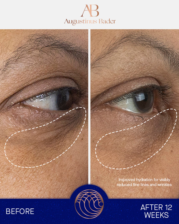 The Eye Cream with TFC8® | Fine lines | LOSHEN & CREM
