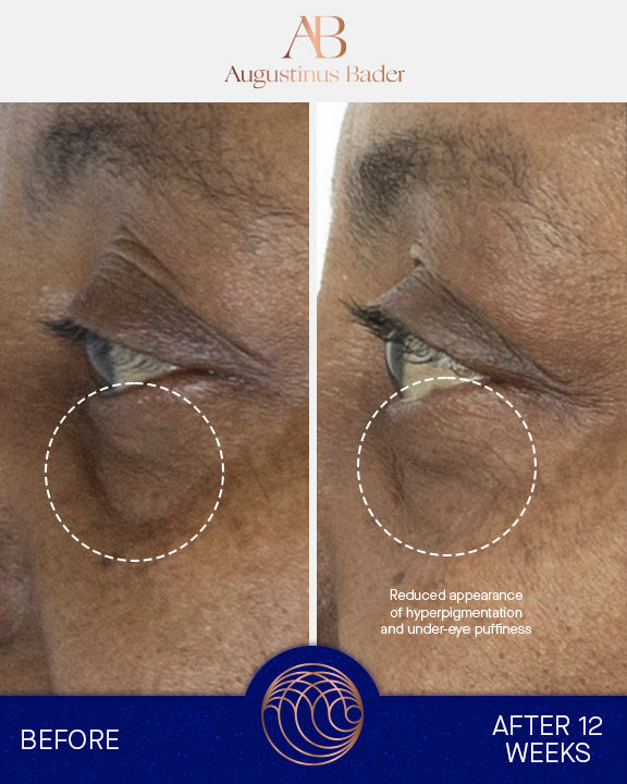 The Eye Cream with TFC8® | Fine lines | LOSHEN & CREM