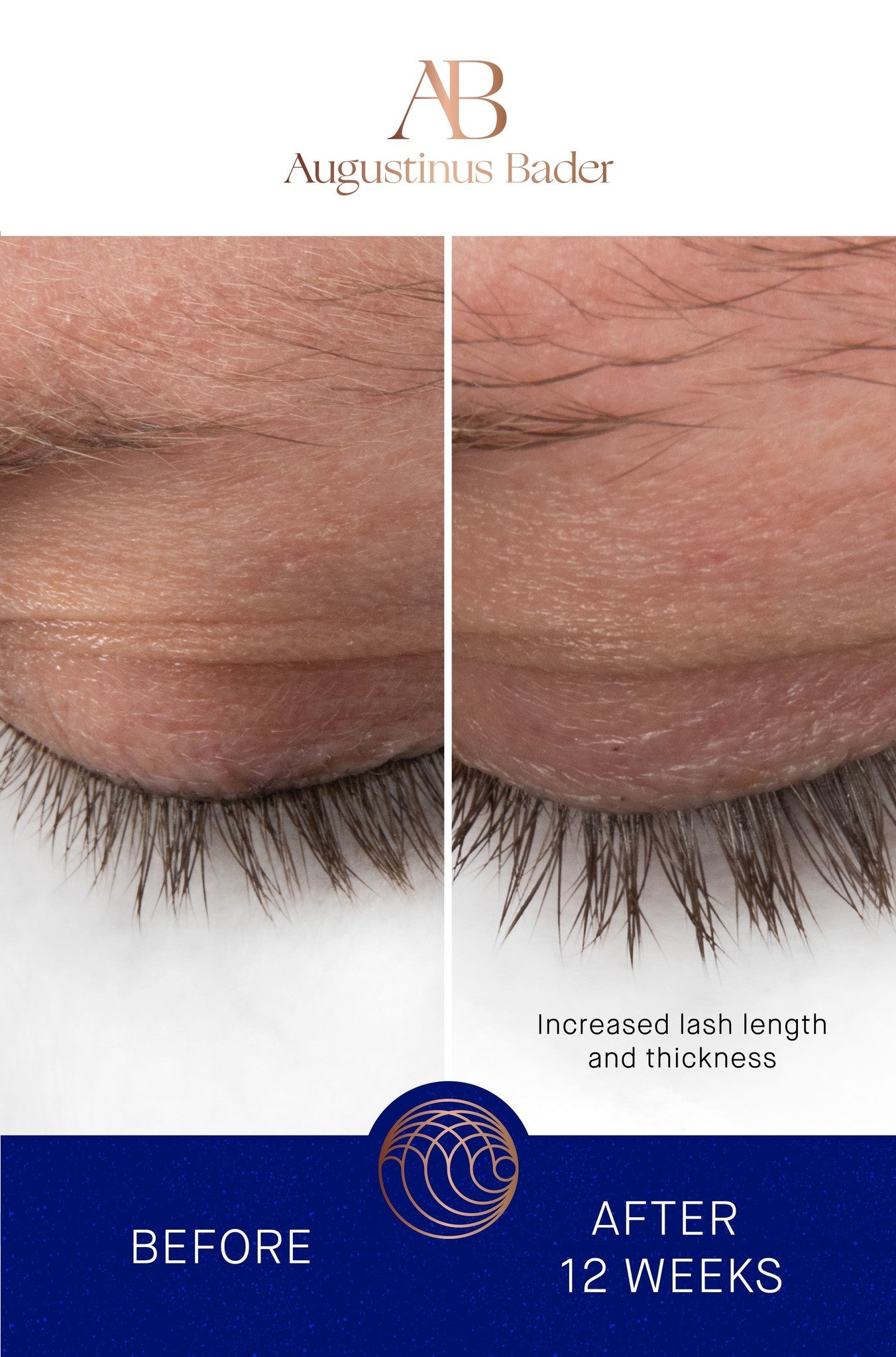 Augustinus Bader The Eyebrow and Lash enhancing serum | Lash & Brow growth treatment | LOSHEN & CREM