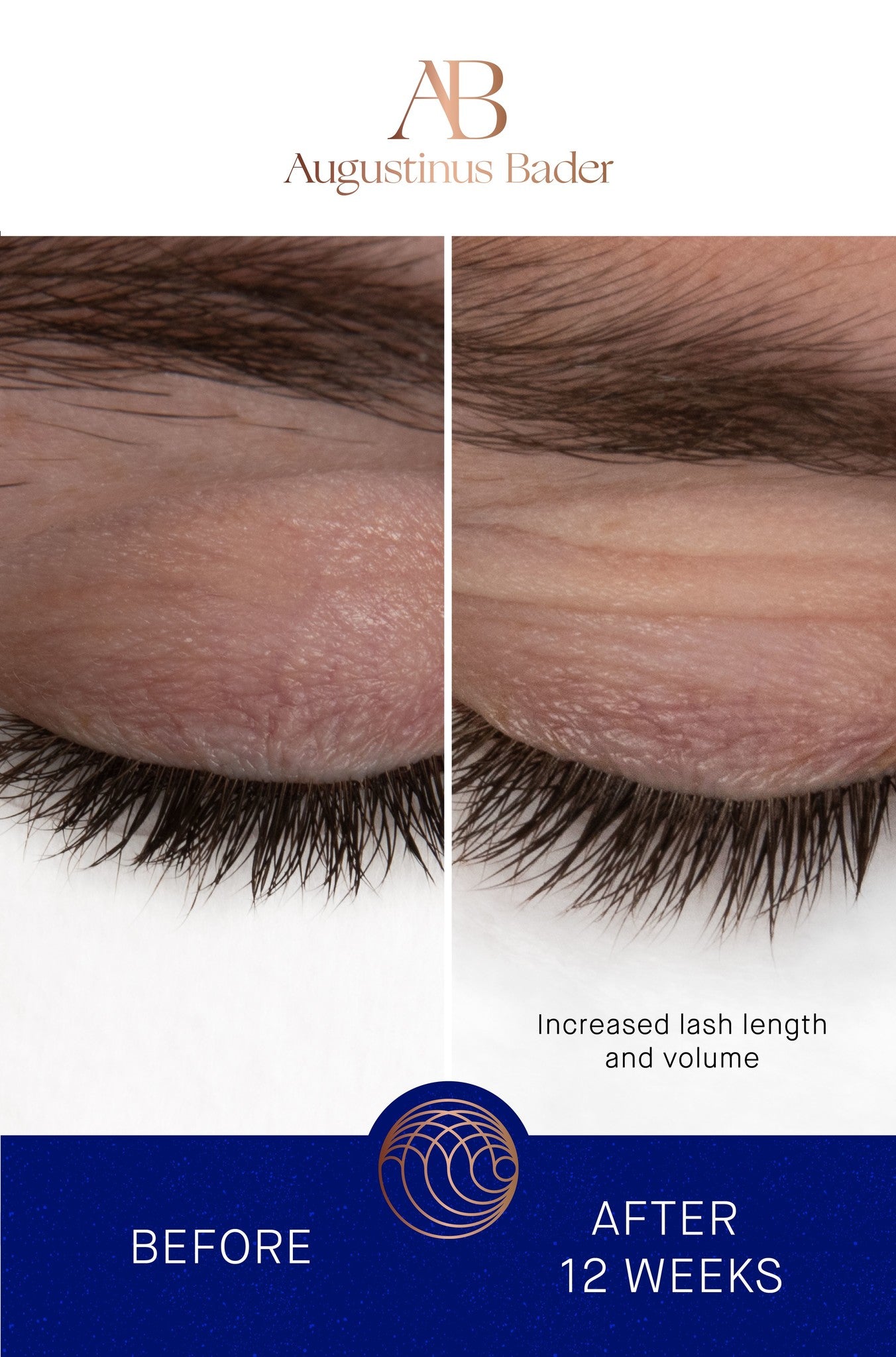 Augustinus Bader The Eyebrow and Lash enhancing serum | Lash & Brow growth treatment | LOSHEN & CREM