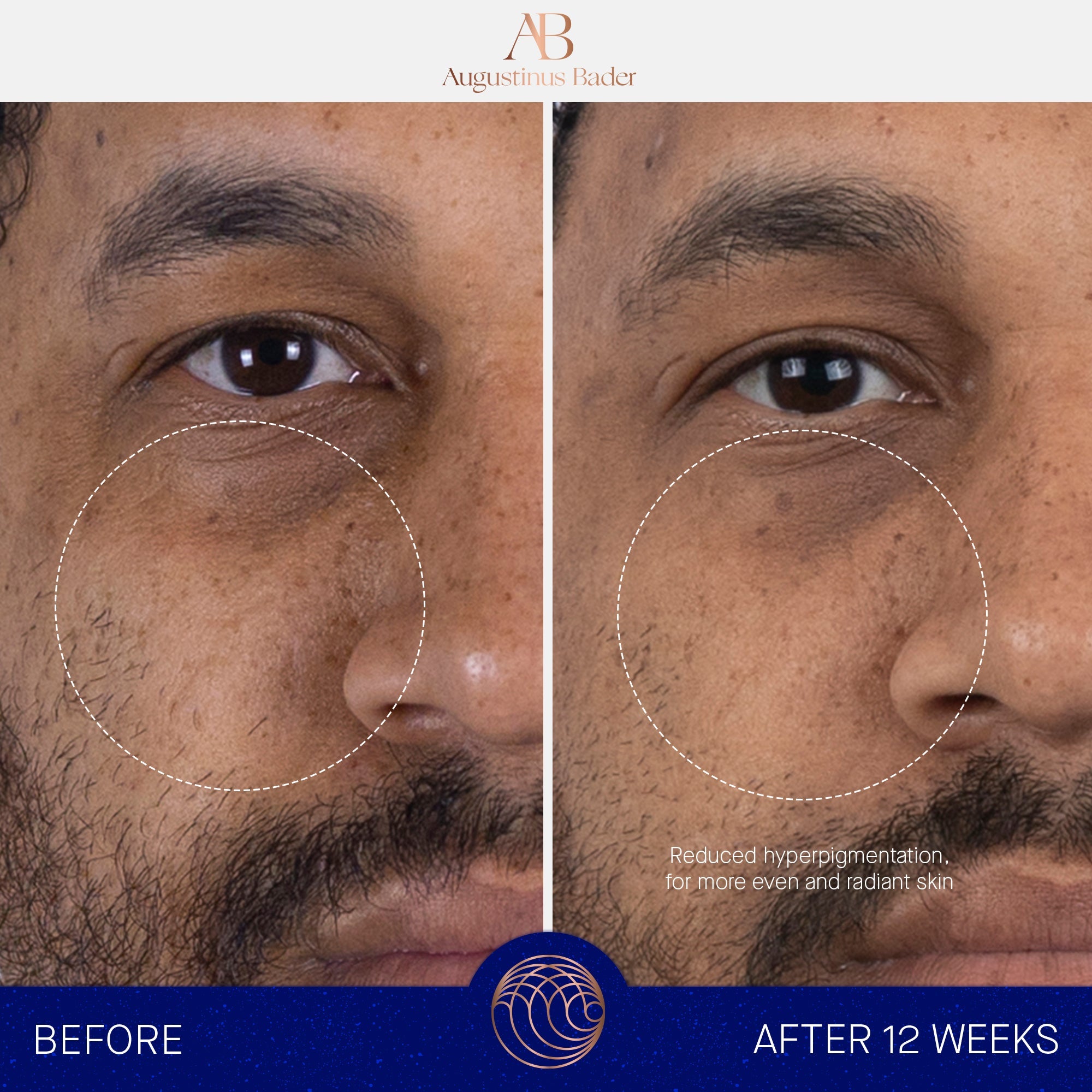 The Serum with TFC8® | Healthy aging serum | LOSHEN & CREM