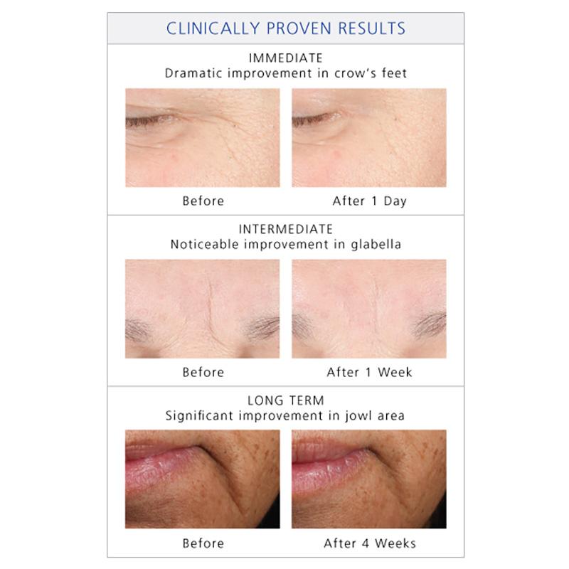 Youth Intensive Creme | Healthy aging cream | LOSHEN & CREM