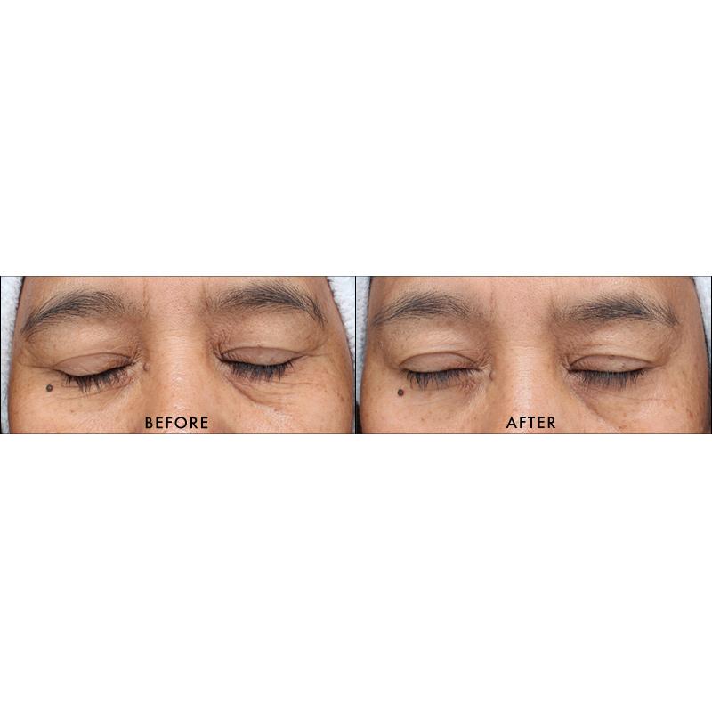 Youth Serum | Firming | Lifting serum | LOSHEN & CREM