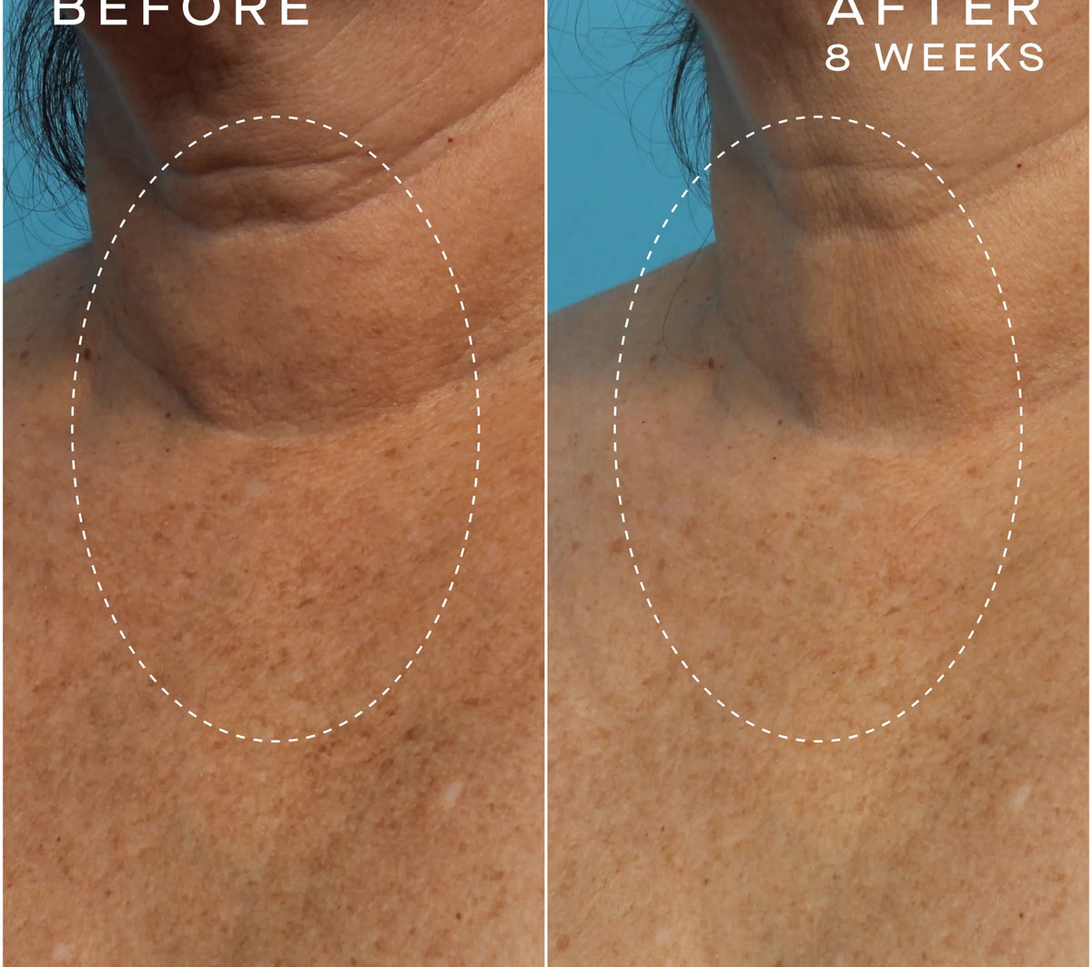 Ourself Advanced Regenerative Serum 30 pump bottle test neck