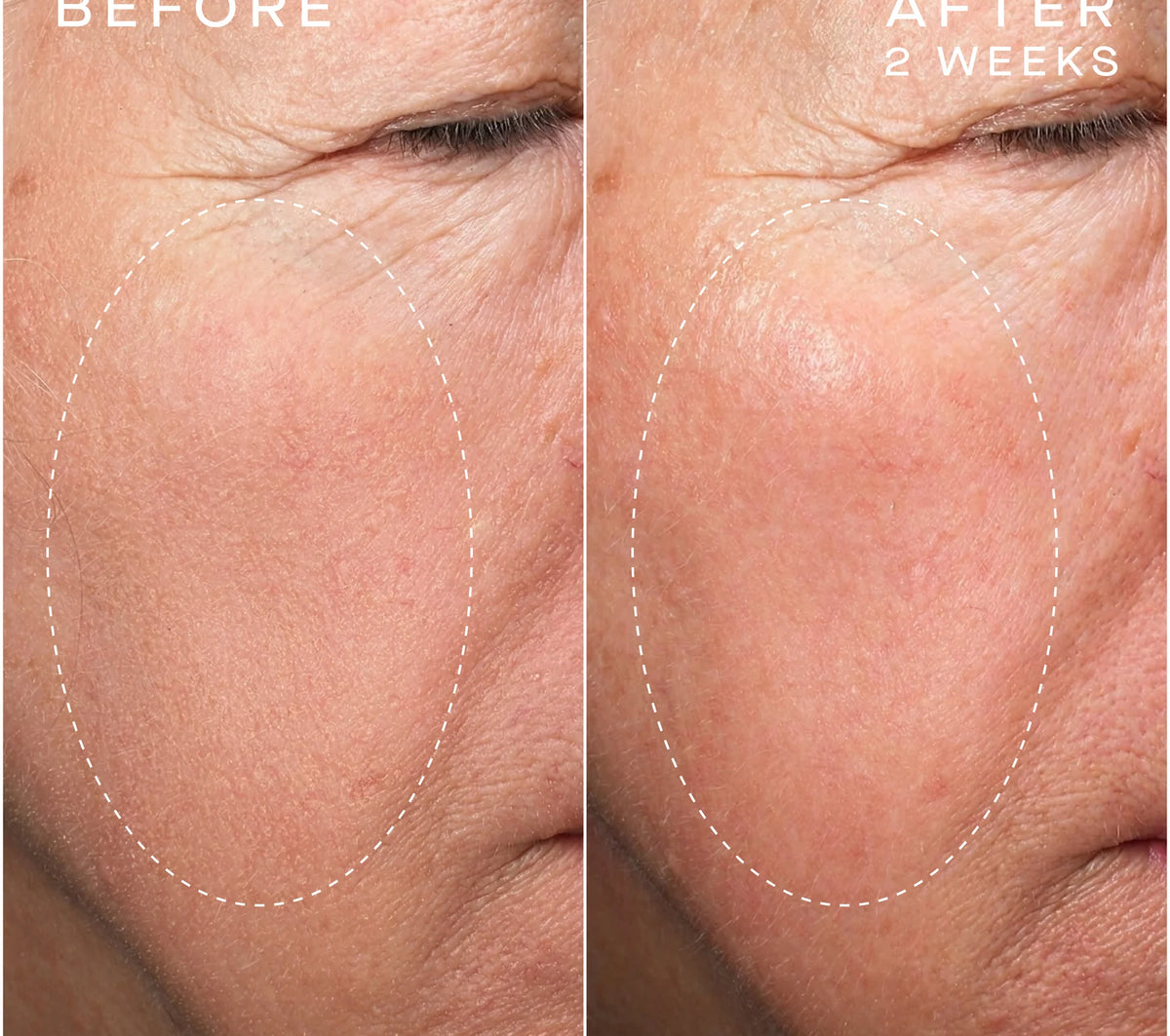 Ourself Advanced Regenerative Serum before