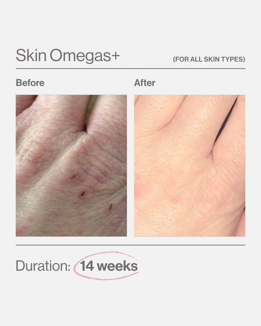 Advanced Nutrition Programme Skin Omegas+