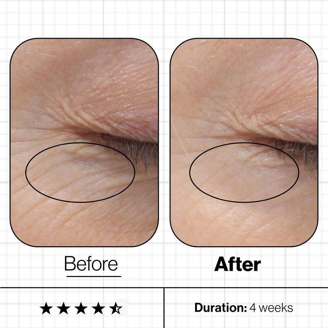 Advanced Nutrition Programme SVB6 Skin Youth Biome™