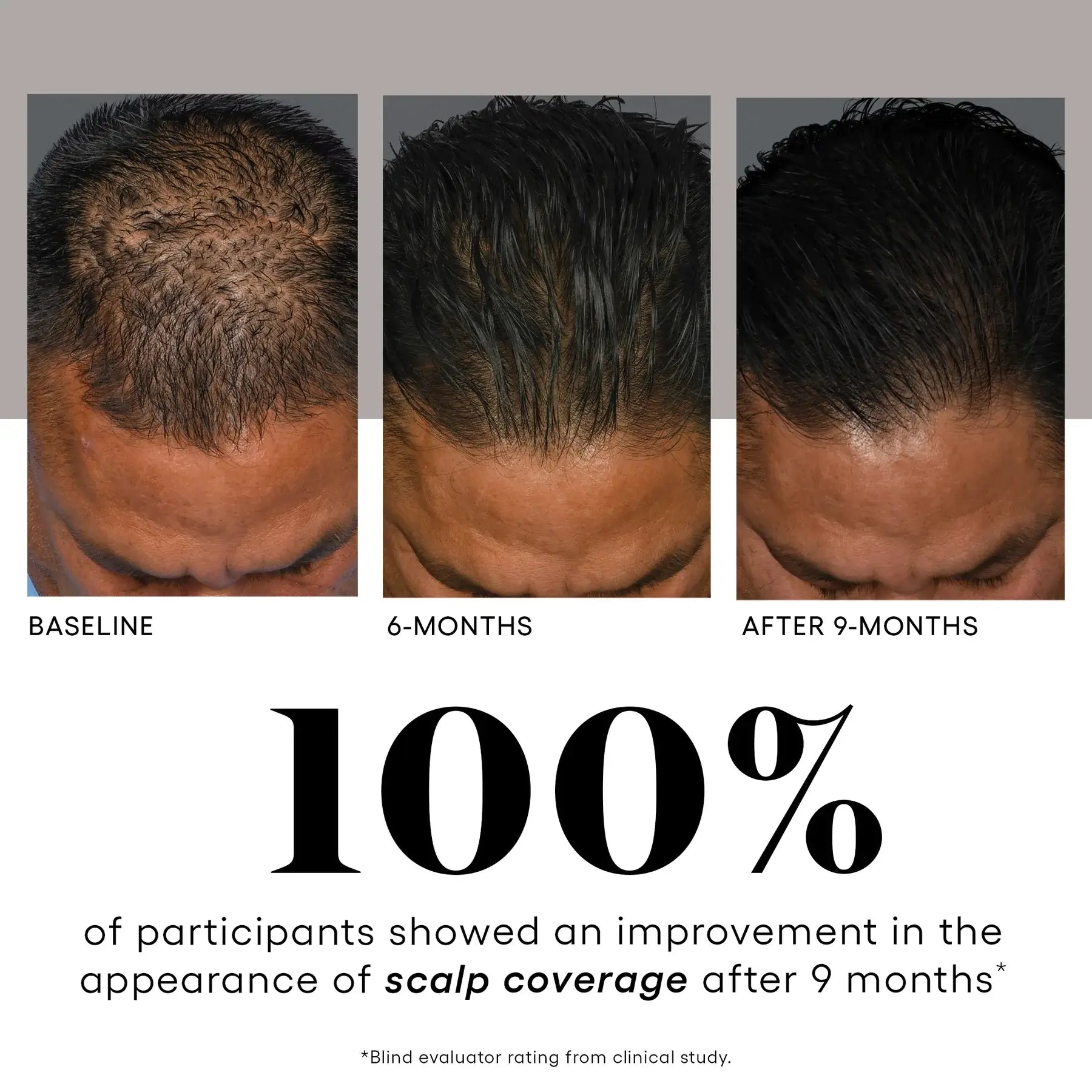 (Plated)™ Hair Serum | Hair - Growth solution | LOSHEN & CREM