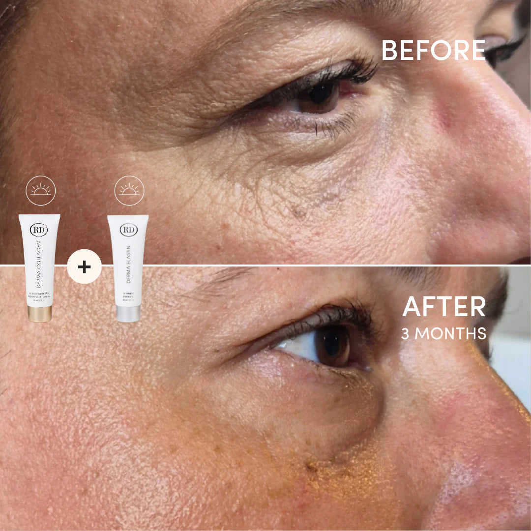 Derma Elastin™ - Firming gel | Gel - Lifting | Firming | LOSHEN & CREM