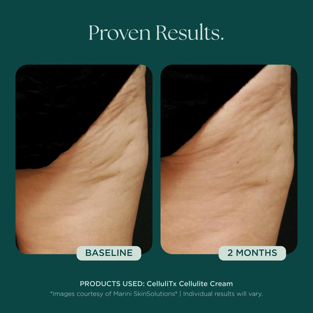 CelluliTX Cellulite Cream | Body - Cellulite care | LOSHEN & CREM