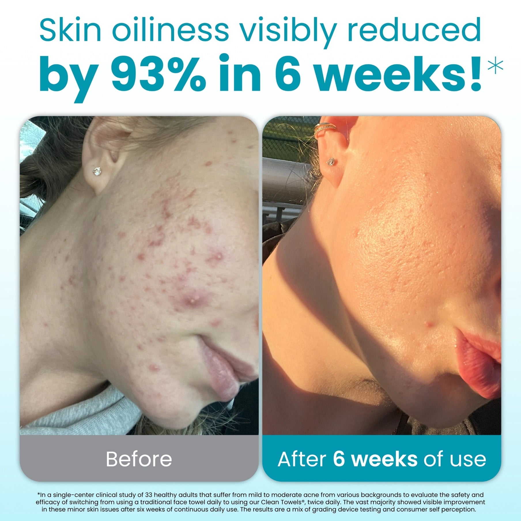 Clean Skin Club Clean Towels® Oily Skin