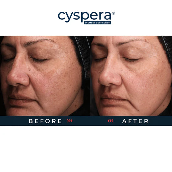 Cyspera® Original +