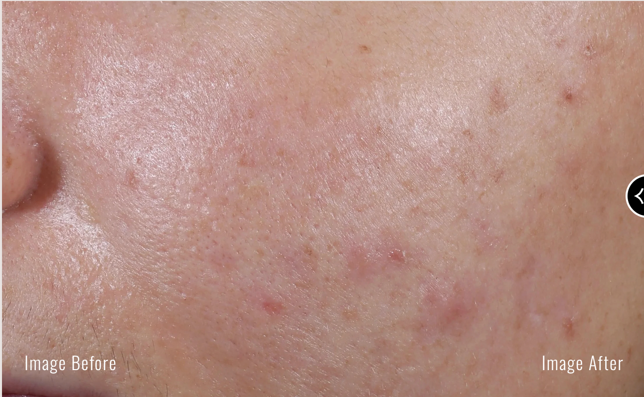 Sérum anti-imperfections DUAL +