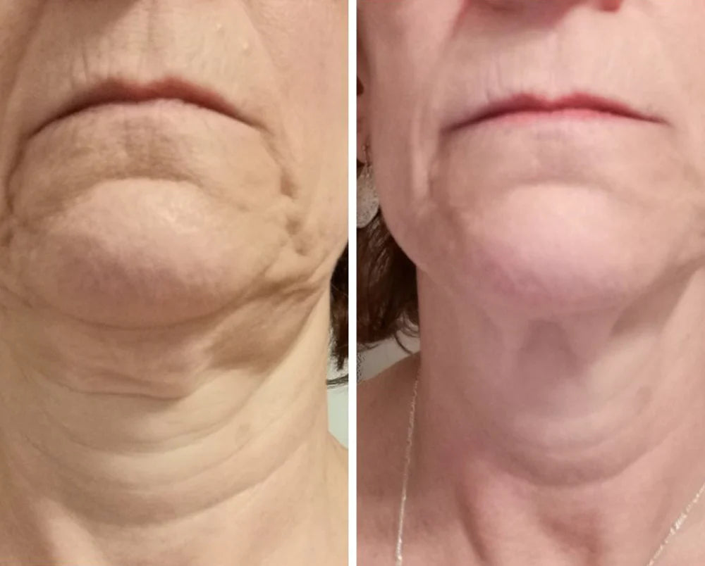DERMA COLLAGEN™ REGENERATIVE ANTI-AGING GEL | Healthy aging serum | LOSHEN & CREM