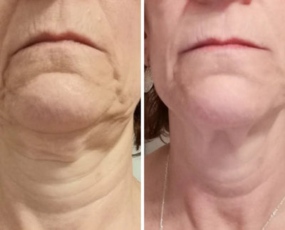 DERMA ELASTIN™ FIRMING GEL | Serum | LOSHEN & CREM