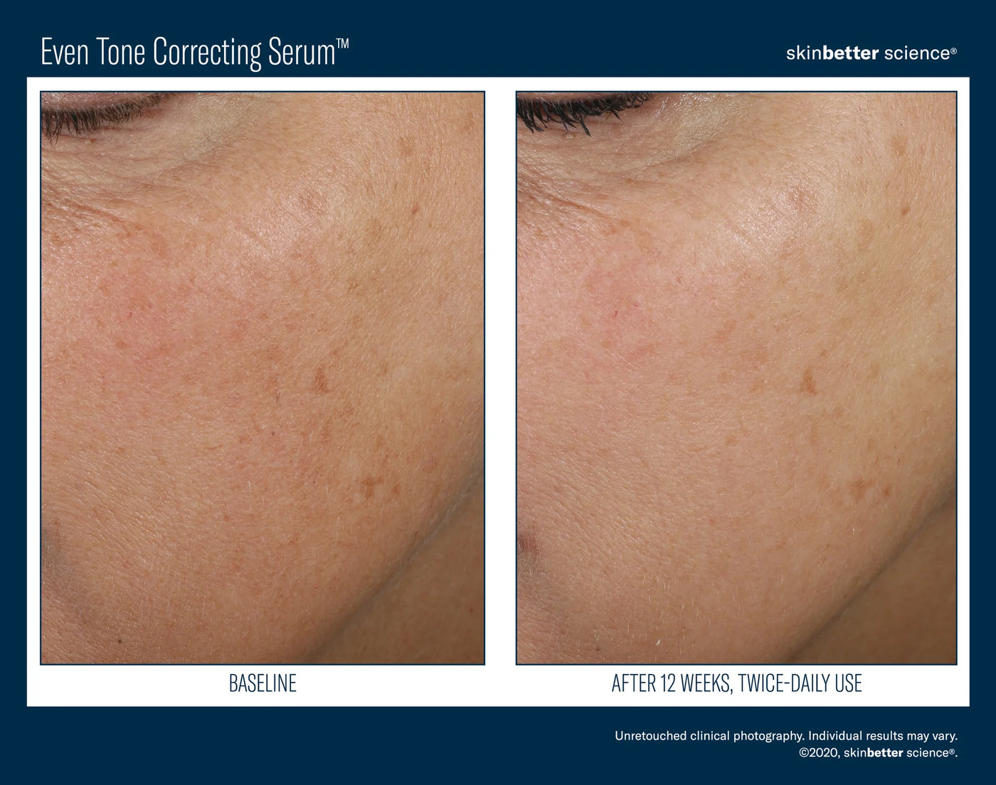 SKINBETTER SCIENCE EVEN TONE CORRECTING SERUM FACE | Serum | LOSHEN & CREM