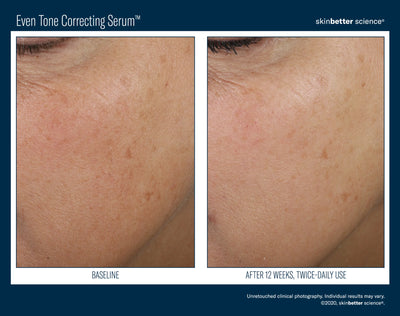 SKINBETTER SCIENCE EVEN TONE CORRECTING SERUM FACE | Serum | LOSHEN & CREM