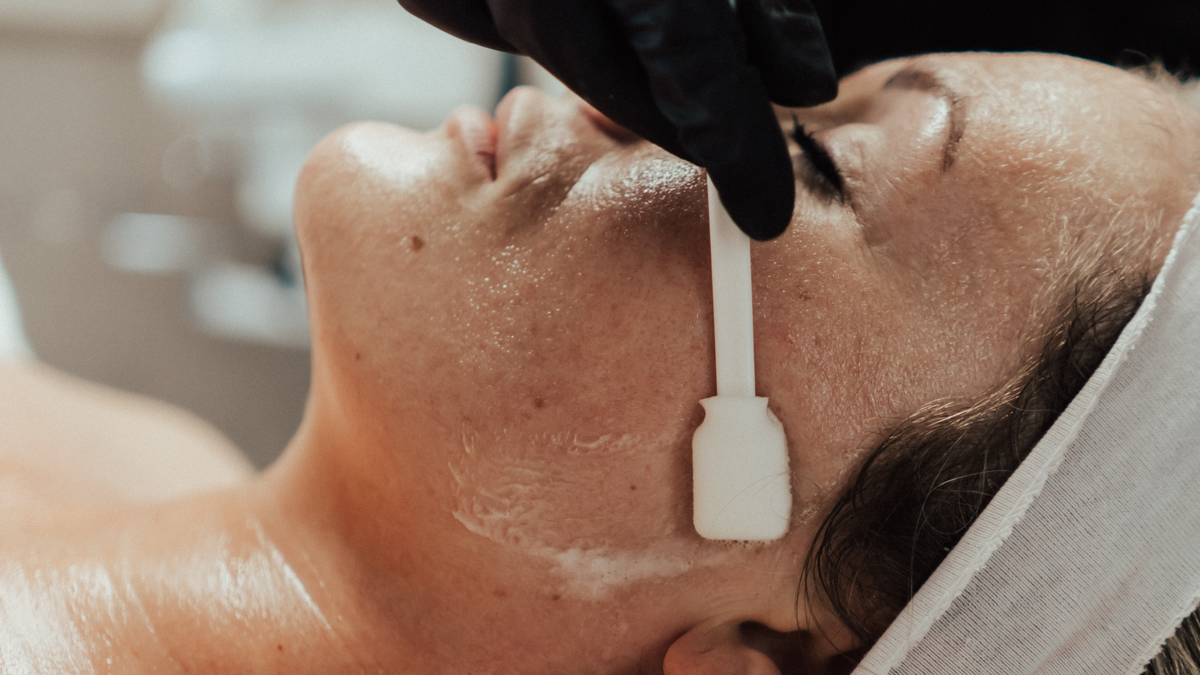 Photographie de soin du visage provenant de la page peeling chimique de Loshen &amp; Crem