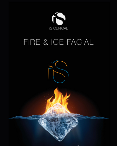 The Fire & Ice experience | Events | LOSHEN & CREM