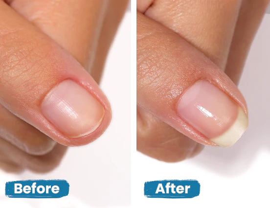 GET STRONG NAIL HARDENER | Nail hardener | LOSHEN & CREM
