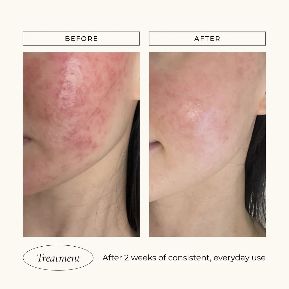Le Mieux Iso-Cell Recovery Solution | Mist - Mineral | LOSHEN & CREM