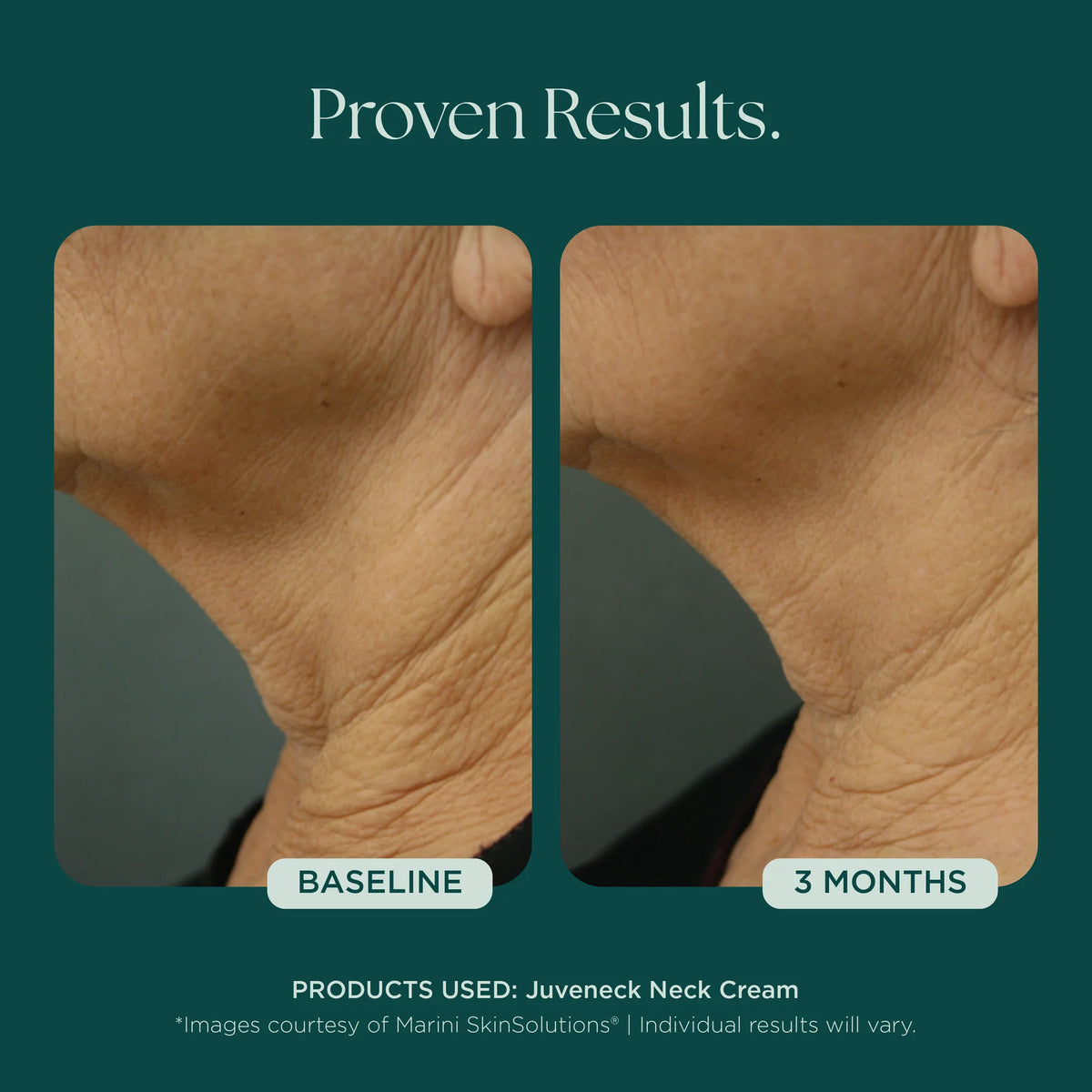 Juveneck Neck Cream | Cream - Neck | LOSHEN & CREM