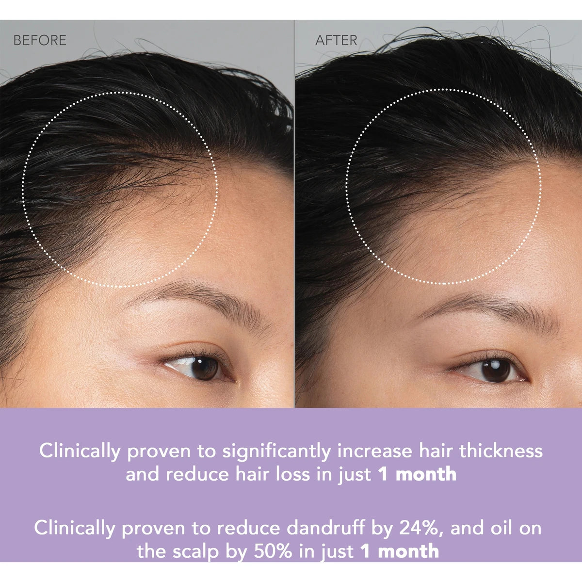 FOREO LUNA™ 4 hair