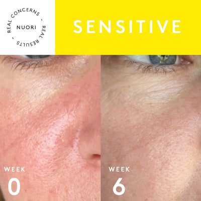 Protect+ Cleansing Milk | Cleansing - Milk | LOSHEN & CREM
