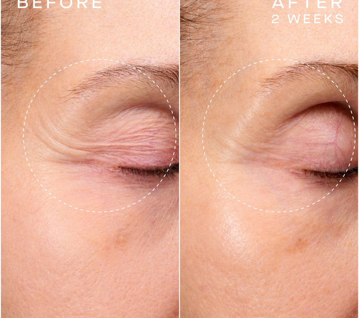 Ourself Advanced Regenerative Serum 30 pump bottle eyes