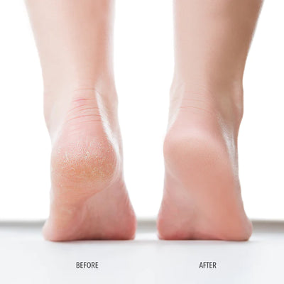 PEDIKUR FOOT BALM | Foot cream | LOSHEN & CREM