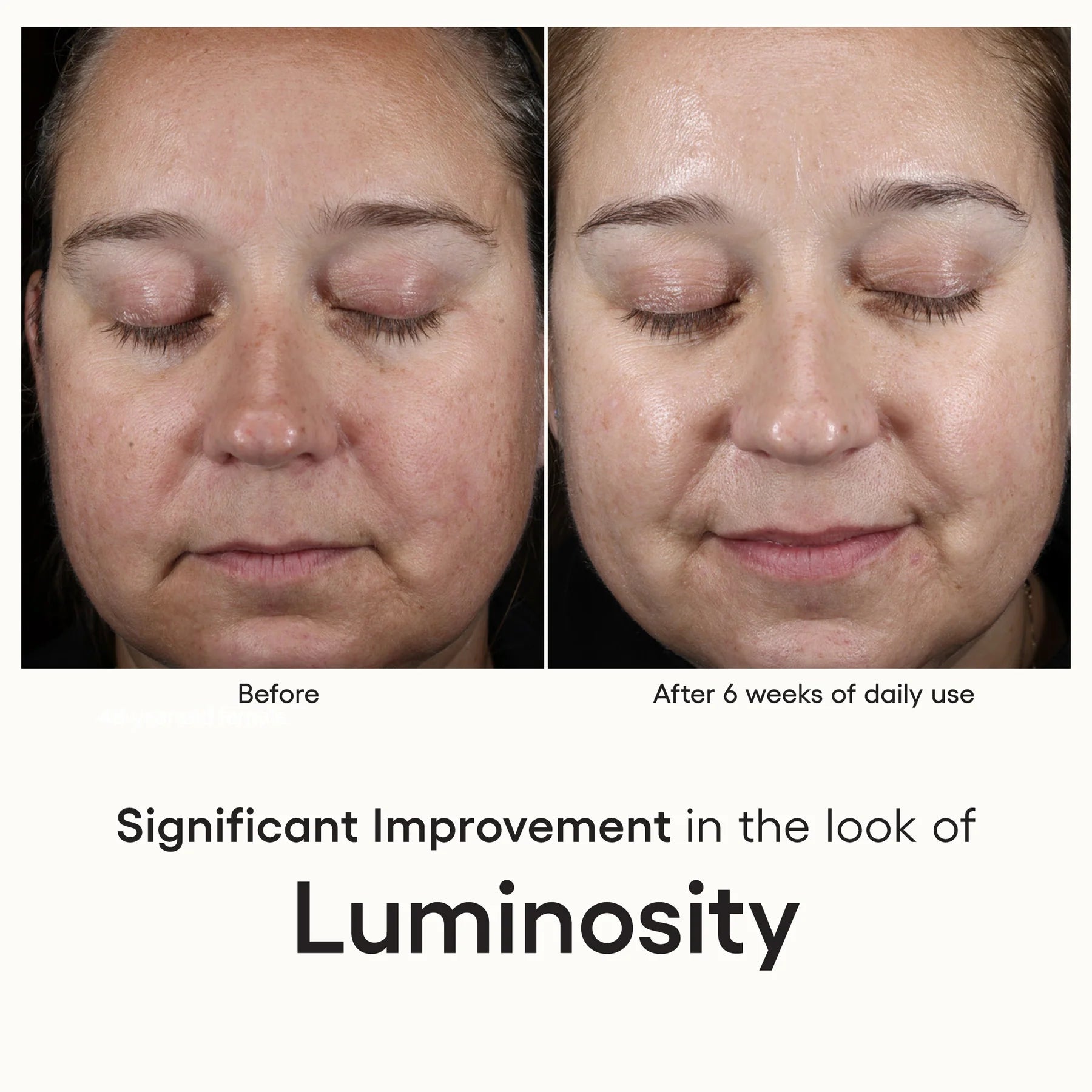 Intense Serum | Advanced Regenerative - Serum | LOSHEN & CREM