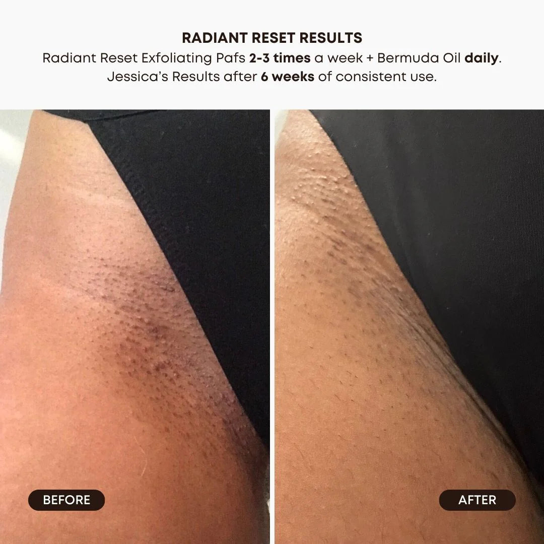 RADIANT RESET EXFOLIATING TONER PADS | Exfoliating pads | LOSHEN & CREM