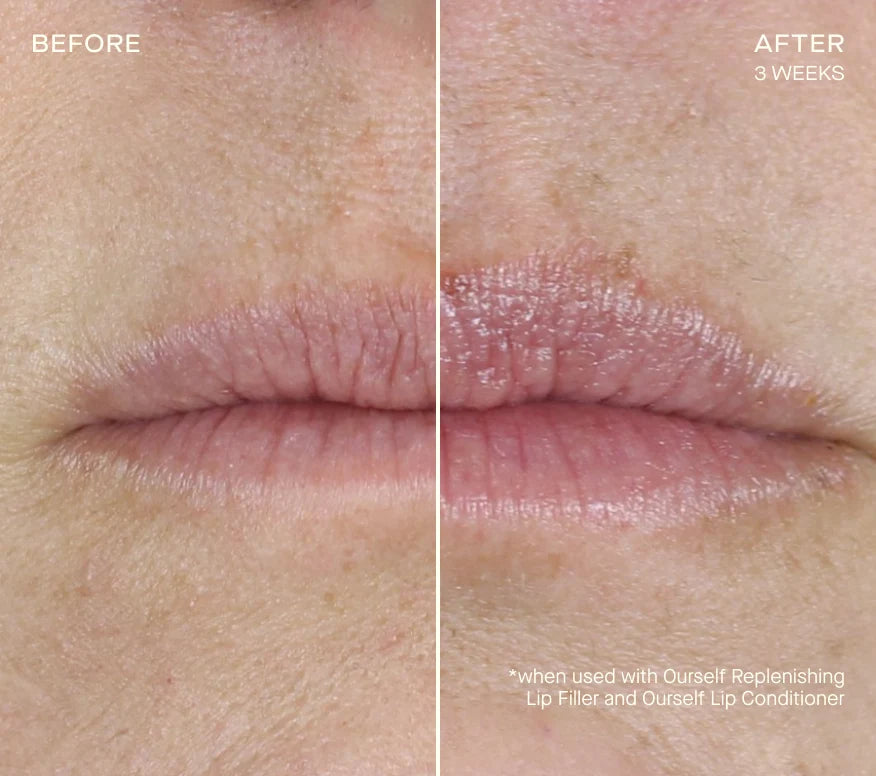 Ourself Replenishing Lip Filler 1.7 mL before