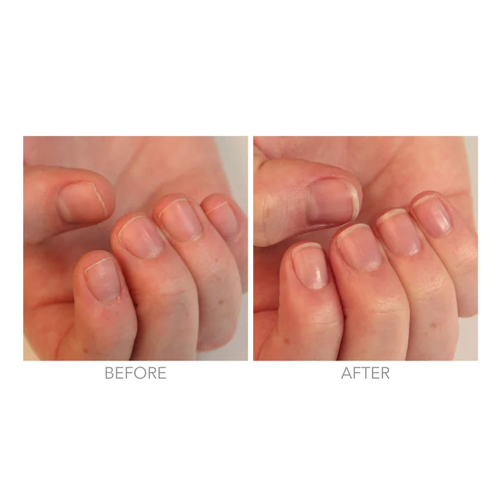 RESTORATIVE NAIL CREAM | Nail Cream | LOSHEN & CREM