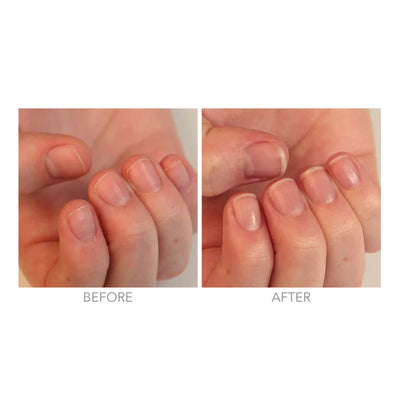 RESTORATIVE NAIL CREAM | Nail Cream | LOSHEN & CREM