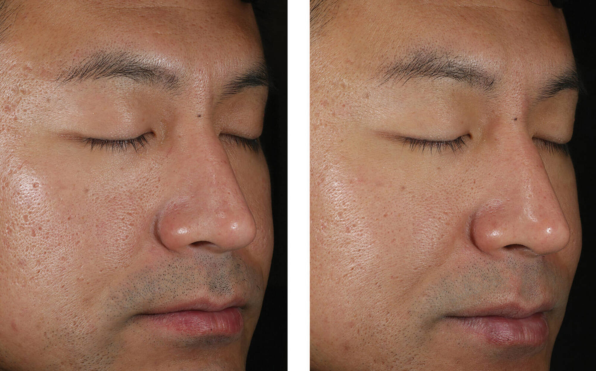 SOLO HYDRATING DEFENSE FOR MEN | Men face cream | LOSHEN & CREM