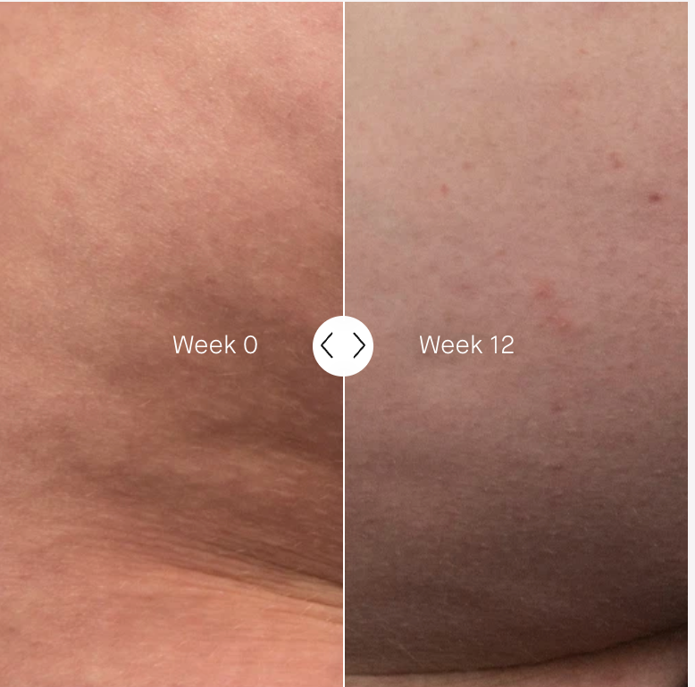 The Geranium Rose Body Cream | Body - Stretch marks | LOSHEN & CREM