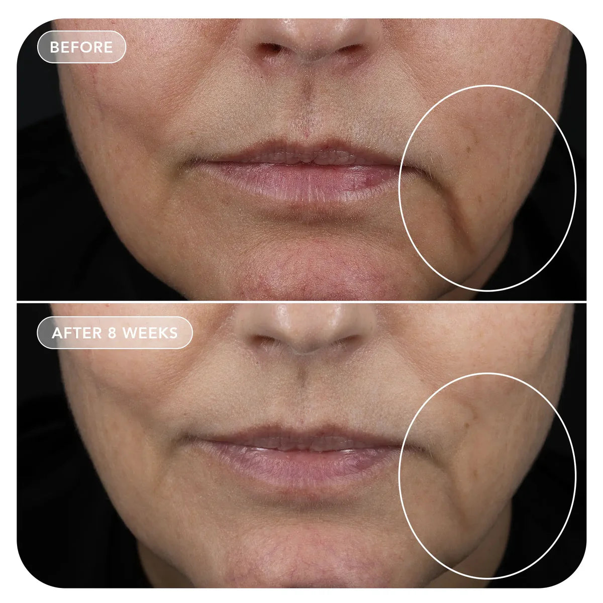 VOL.U.LIFT™ GLP-1 4D Skin Rebound Complex | Cream - GLP-1 | LOSHEN & CREM