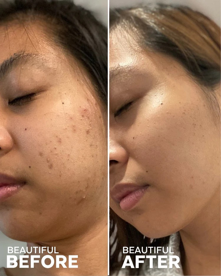 BEST SELLERS DISCOVERY KIT | Skin Care | LOSHEN & CREM