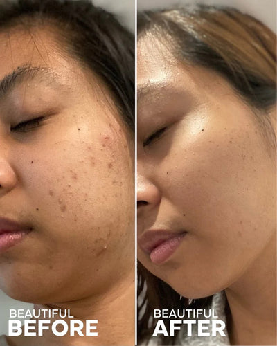 BEST SELLERS DISCOVERY KIT | Skin Care | LOSHEN & CREM