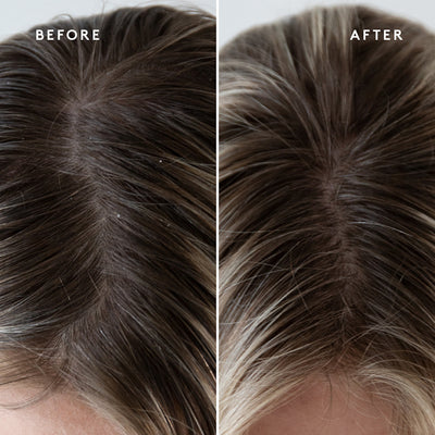 VIRTUE REFRESH EXFOLIATING SCALP TREATMENT | Scalp treatment | LOSHEN & CREM