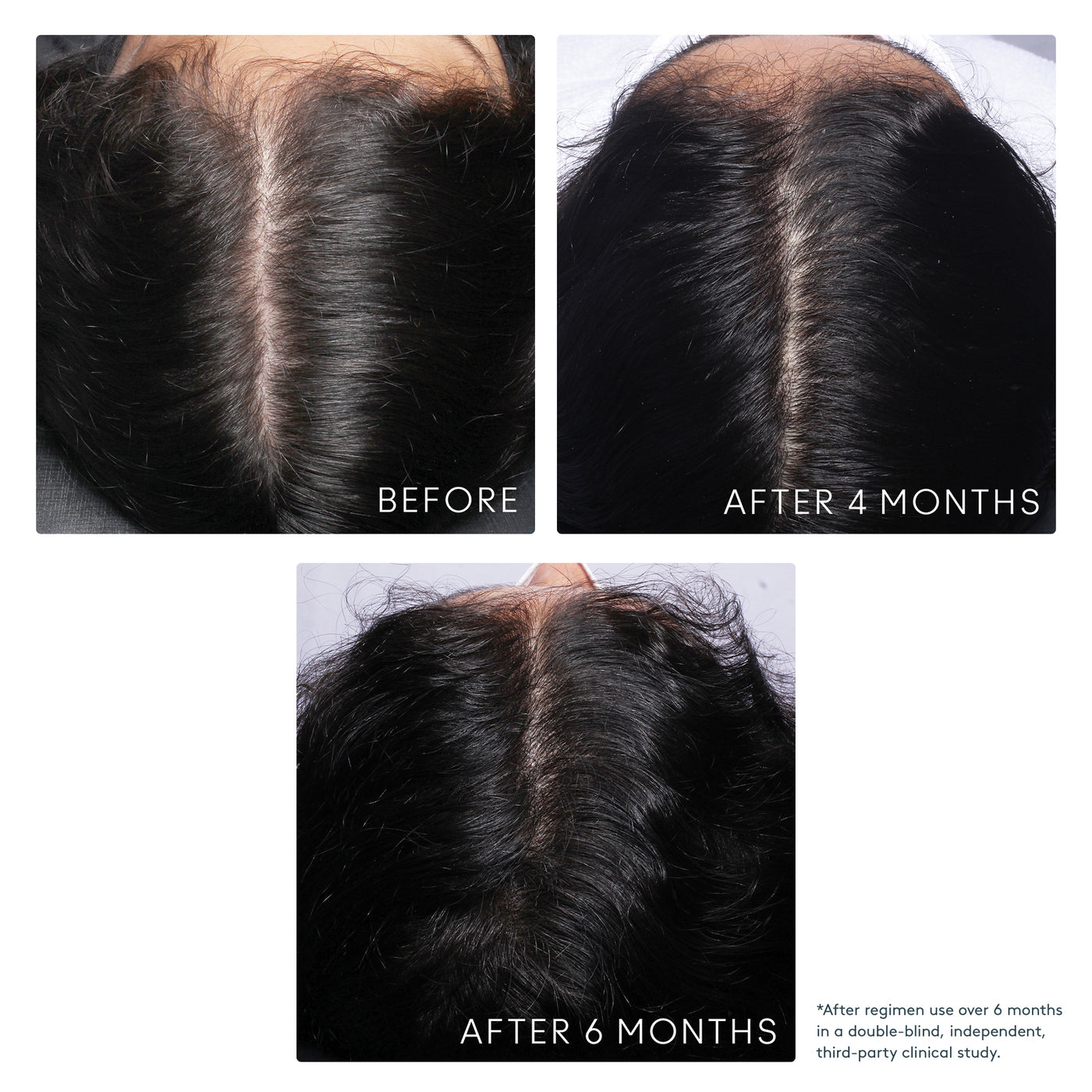 VIRTUE FLOURISH SHAMPOO FOR THINNING HAIR | Thinning hair | LOSHEN & CREM