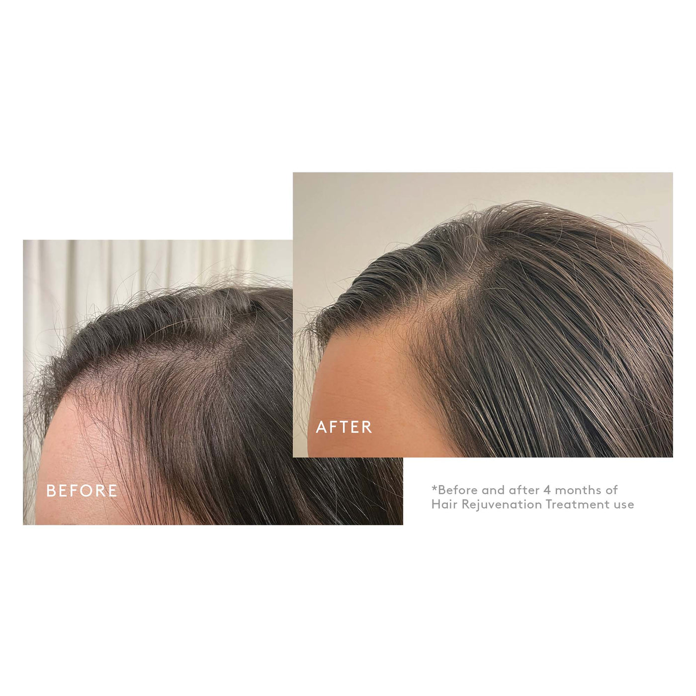 VIRTUE FLOURISH DENSITY BOOSTER | Thinning hair | LOSHEN & CREM