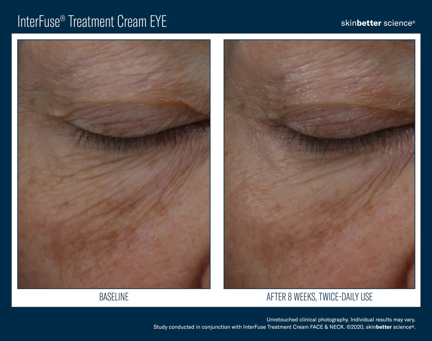 INTERFUSE TREATMENT CREAM EYE | Eye Cream | LOSHEN & CREM