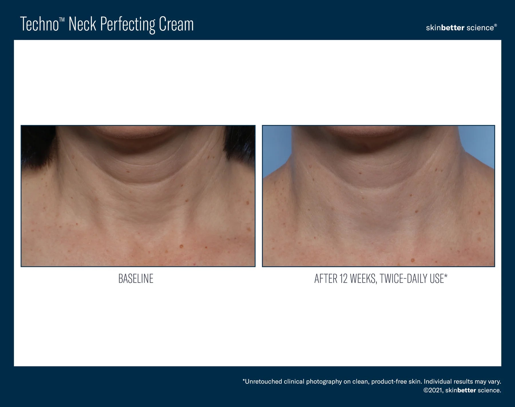 TECHNO NECK PERFECTING CREAM | Face and neck cream | LOSHEN & CREM